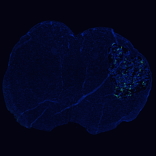 Coronal brain section showing peptide accumulation concentrated in the glioblastoma relative to surrounding healthy tissue