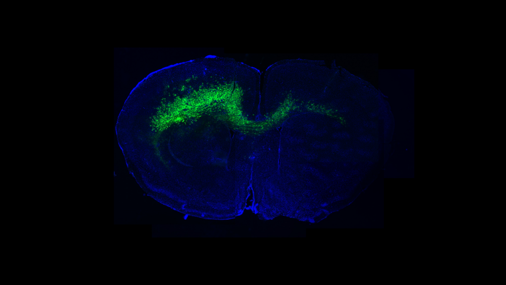 Coronal section of a GFP-labeled mouse glioma (green) showing extensive infiltration along white matter into the contralateral hemisphere, against a DAPI-stained (blue) background
