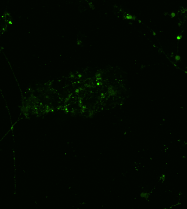 Control, synaptic marker channel alone