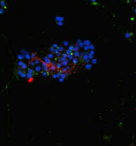 Control, merged channels: synapses, processes, and nuclei