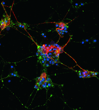 +GPC5, merged channels: synapses, processes, and nuclei