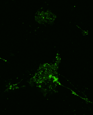 +GPC5 +peptide, synaptic marker channel alone