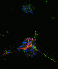 +GPC5 +peptide, merged channels: synapses, processes, and nuclei