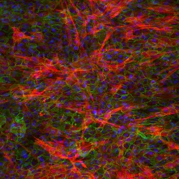 Confocal fluorescence image of cultured cells showing dense cytoskeletal and nuclear staining